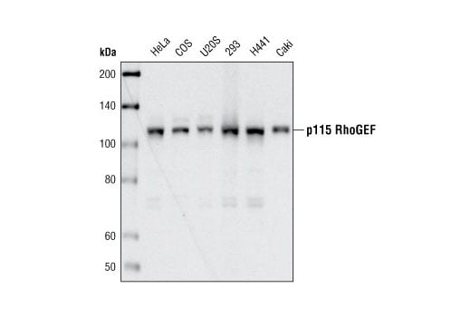 Western Blotting Image 1: p115 RhoGEF (D25D2) XP<sup>®</sup> Rabbit mAb