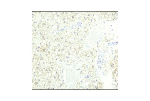 Immunohistochemistry Image 2: ATGL (30A4) Rabbit Monoclonal Antibody