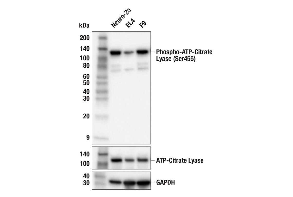 Western Blotting Image 4: Phospho-ATP-Citrate Lyase (Ser455) (F4T8R) Rabbit Monoclonal Antibody