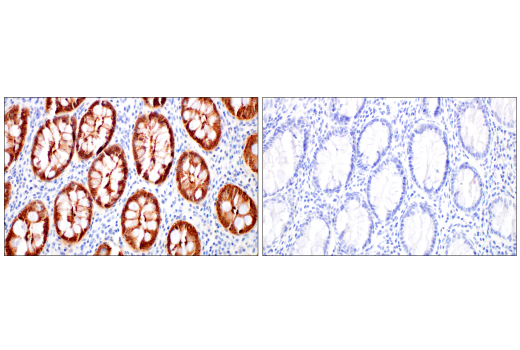 Immunohistochemistry Image 7: Villin-1 (CWWB1) Mouse Monoclonal Antibody