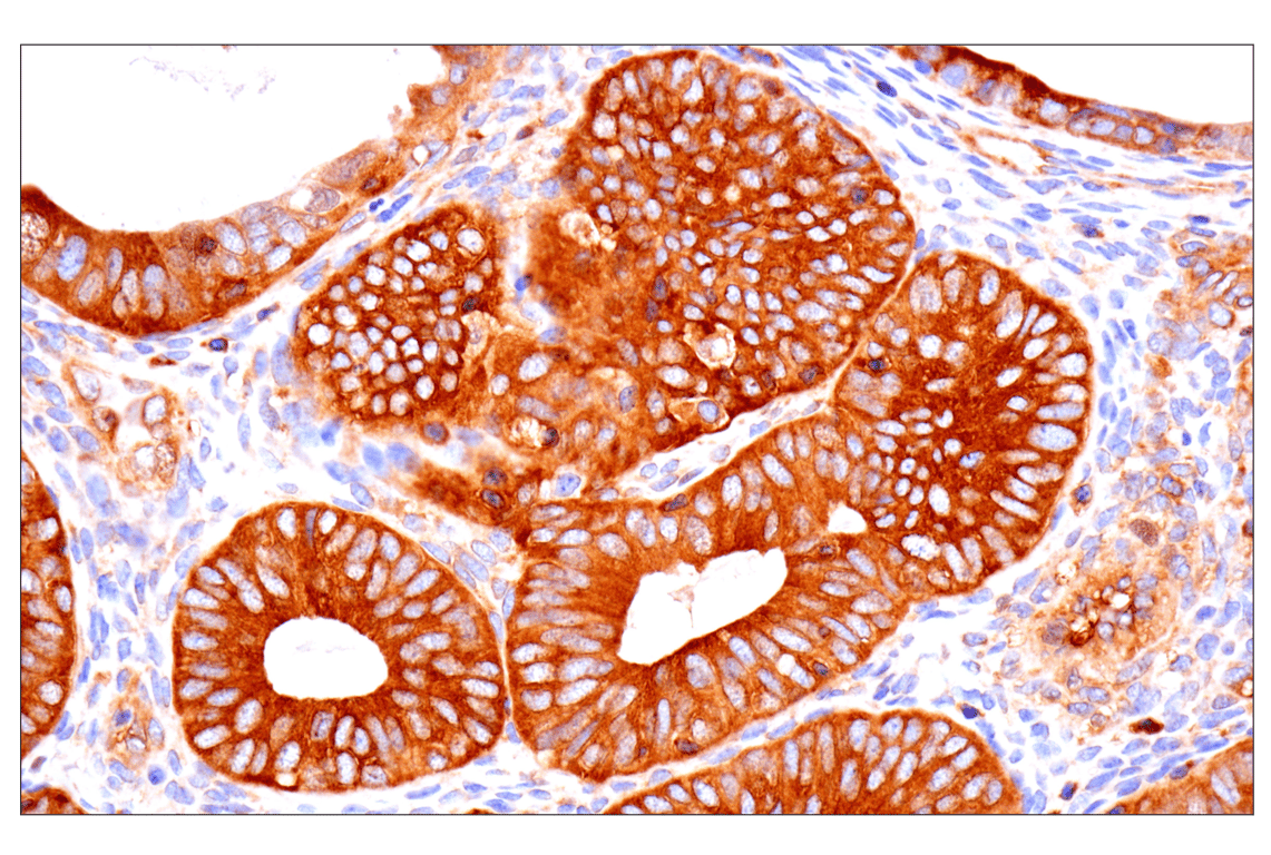 Immunohistochemistry Image 1: NF-kappaB p65 (D14E12) Rabbit Monoclonal Antibody (BSA and Azide Free)