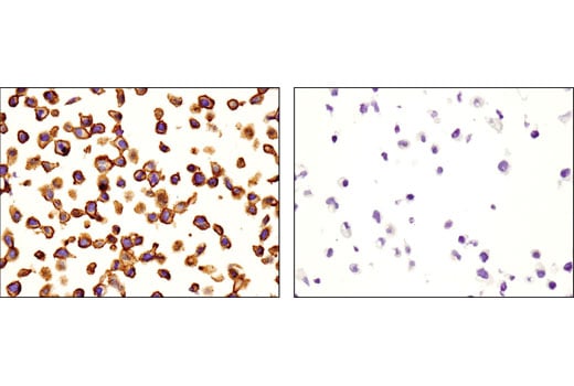 Immunohistochemistry Image 1: CD46 (D6N7H) Rabbit Monoclonal Antibody