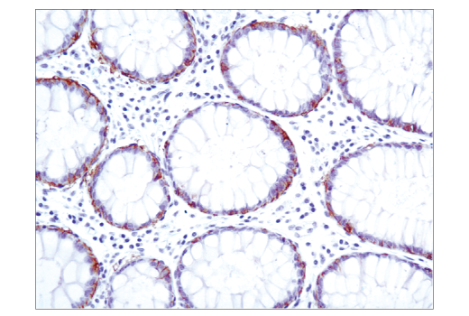 Immunohistochemistry Image 2: EpCAM (VU1D9) Mouse Monoclonal Antibody (BSA and Azide Free)