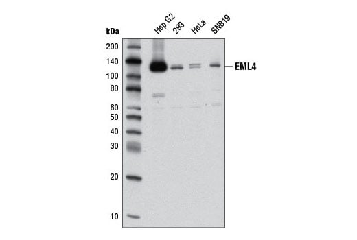 Western Blotting Image 1: EML4 (D5V6M) Rabbit mAb