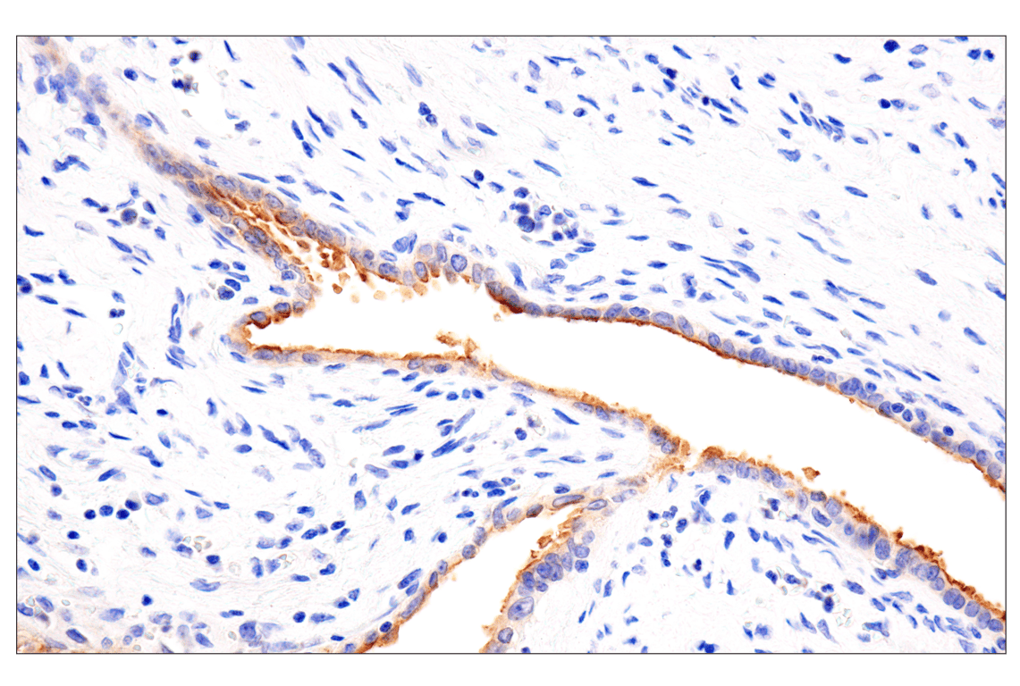 Immunohistochemistry Image 6: Folate Receptor Alpha/FOLR1 (BN3.2) Mouse Monoclonal Antibody