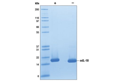 undefined Image 2: Mouse Interleukin-10 (mIL-10)