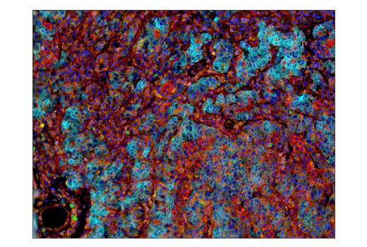 Immunohistochemistry Image 7: VISTA (D1L2G) Rabbit Monoclonal Antibody (BSA and Azide Free)