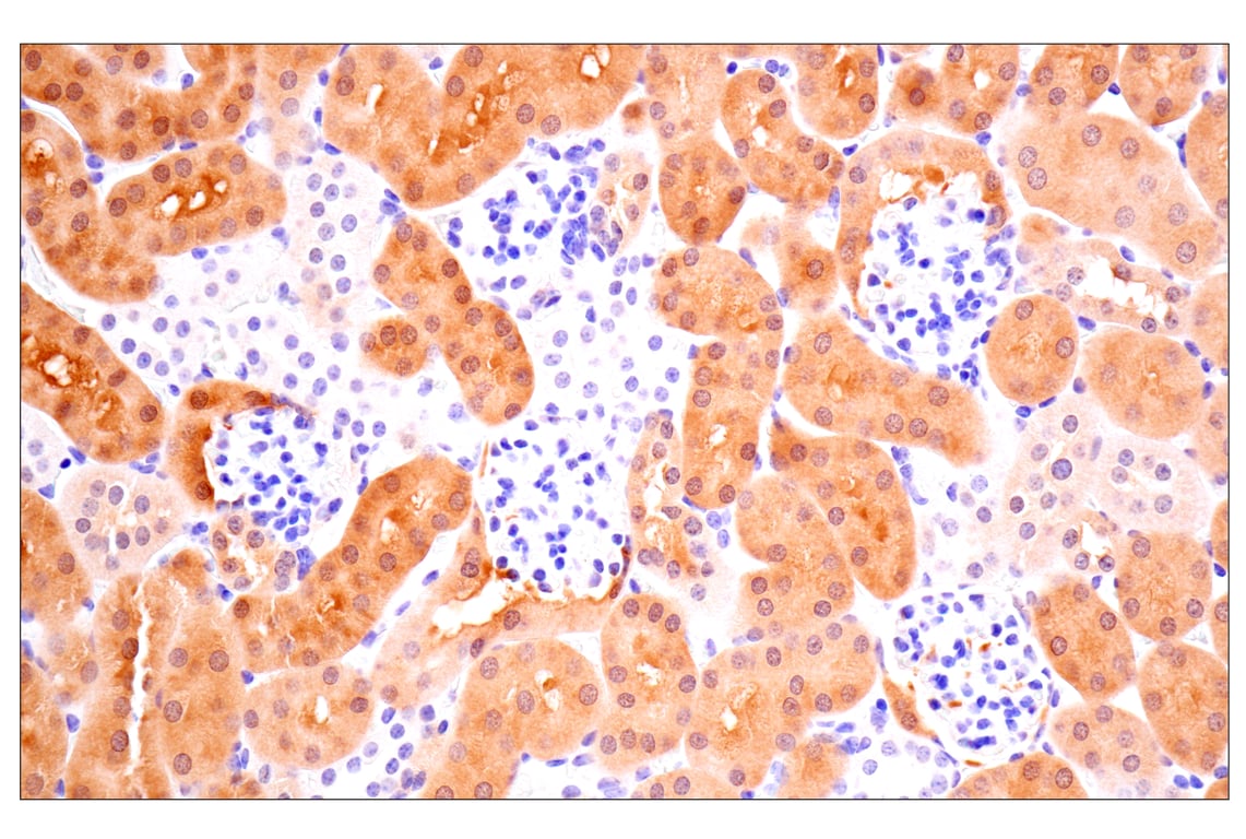Immunohistochemistry Image 13: ACBP/DBI (E4V8V) Rabbit Monoclonal Antibody