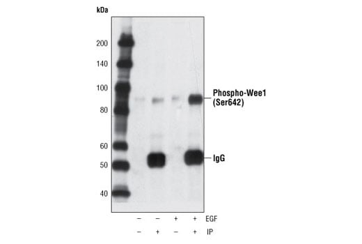 Immunoprecipitation Image 1: Phospho-Wee1 (Ser642) (D47G5) Rabbit Monoclonal Antibody