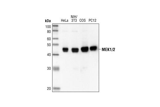 Western Blotting Image 1: MEK1/2 (47E6) Rabbit mAb