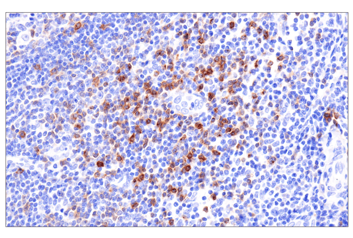 Immunohistochemistry Image 7: CCR4 (F9A9K) Rabbit Monoclonal Antibody
