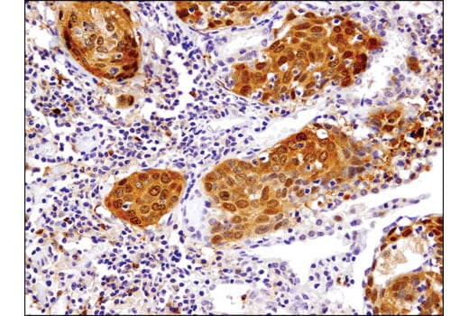 Immunohistochemistry Image 1: TRXR1 (D1T3D) Rabbit Monoclonal Antibody