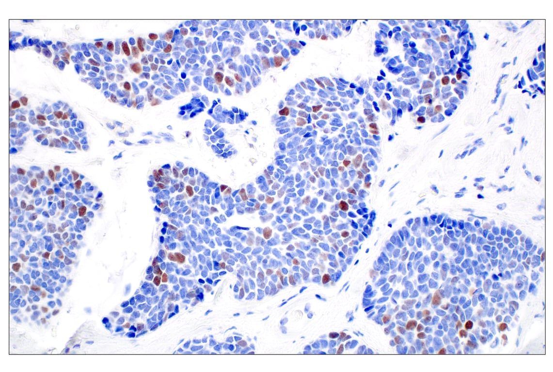 Immunohistochemistry Image 6: BRCA1 (E5S9G) Rabbit Monoclonal Antibody