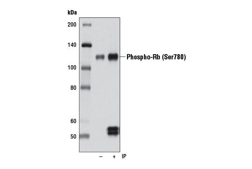 undefined Image 11: Rb Antibody Sampler Kit