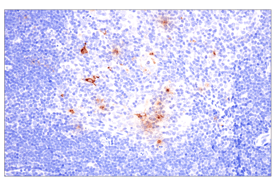 Immunohistochemistry Image 5: Eosinophil cationic protein (F3G7N) Rabbit Monoclonal Antibody (BSA and Azide Free)
