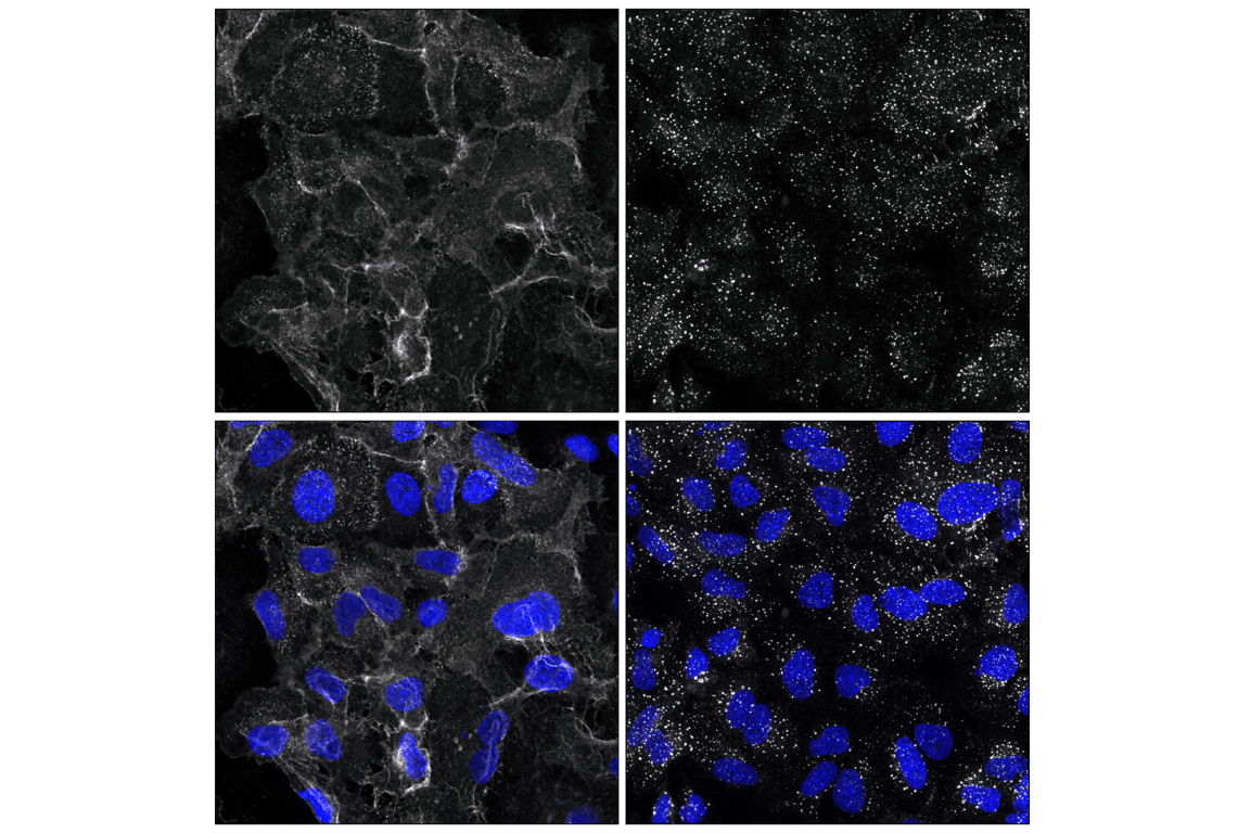 Immunofluorescence Image 1: EGF Receptor (D38B1) Rabbit Monoclonal Antibody (Alexa Fluor<sup>®</sup> 647 Conjugate)