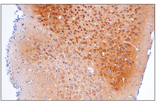 Immunohistochemistry Image 2: Phospho-Tau (Thr205) (E7D3E) Rabbit Monoclonal Antibody (BSA and Azide Free)