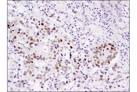 Immunohistochemistry Image 1: PROX1 (D2J6J) Rabbit Monoclonal Antibody (BSA and Azide Free)
