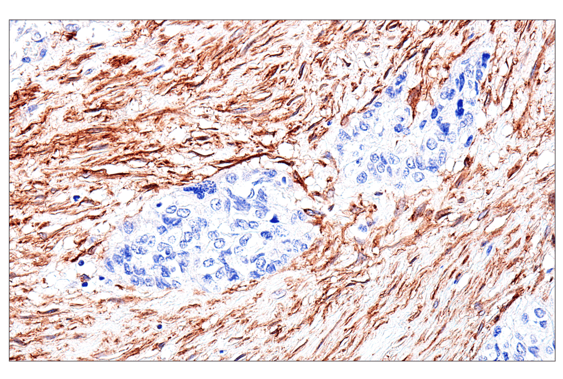 Immunohistochemistry Image 5: FAP (F1A4G) Rabbit Monoclonal Antibody