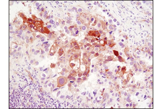 Immunohistochemistry Image 2: NDRG1 (D8G9) Rabbit Monoclonal Antibody (BSA and Azide Free)