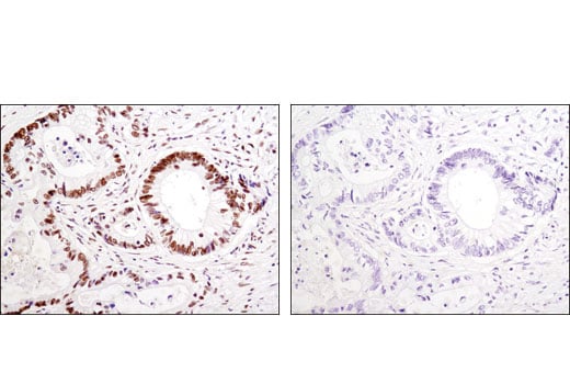 Immunohistochemistry Image 2: HSF1 (D3L8I) Rabbit Monoclonal Antibody