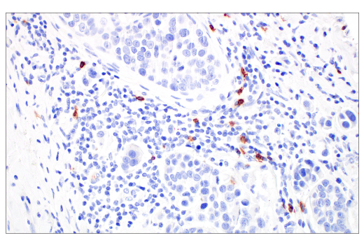 Immunohistochemistry Image 1: TRDC/TCR delta (E2E9T) Rabbit Monoclonal Antibody (BSA and Azide Free)