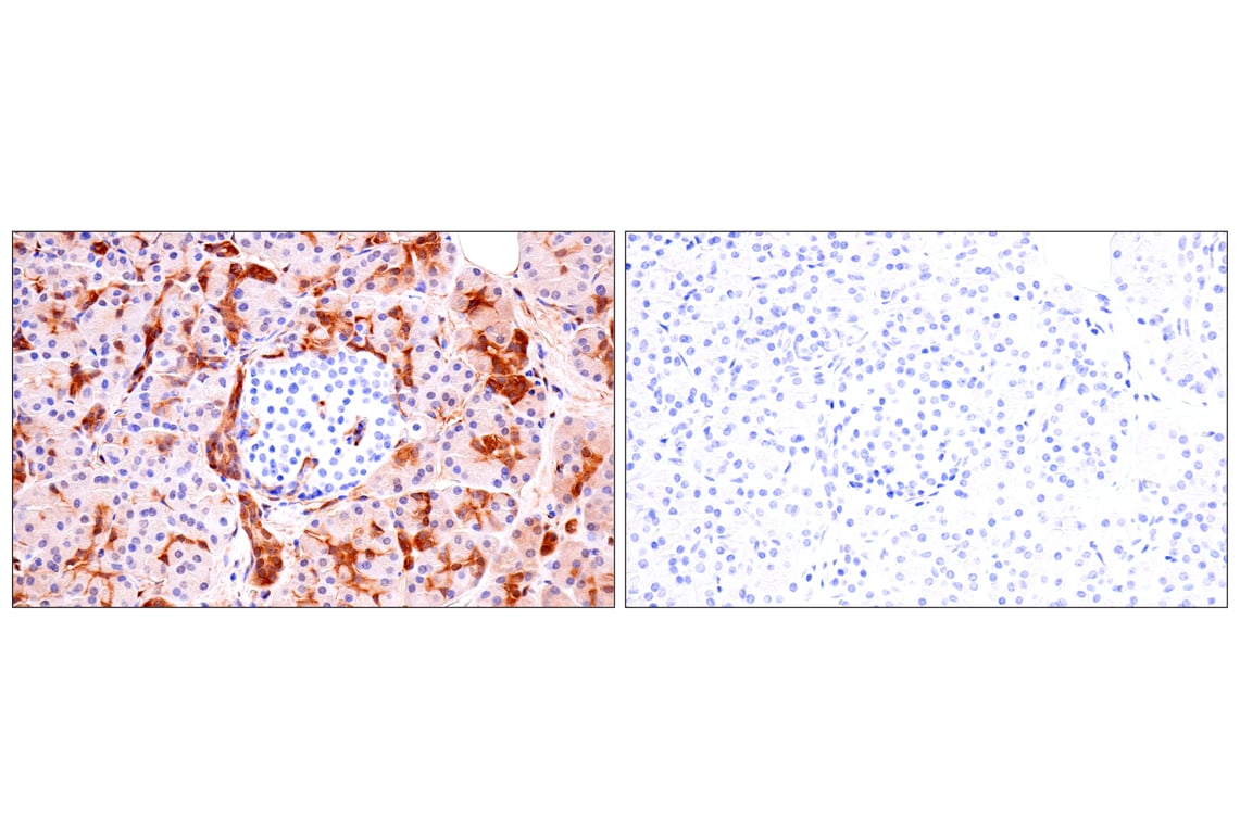 Immunohistochemistry Image 13: Phospho-YAP (Ser61) (E4Q8S) Rabbit Monoclonal Antibody