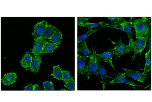 Immunofluorescence Image 1: Merlin/Ezrin/Radixin/Moesin (D1P8I) Rabbit Monoclonal Antibody
