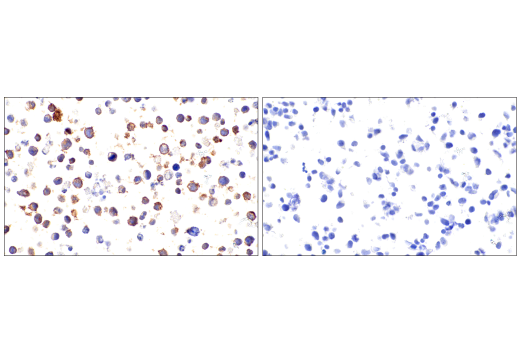 Immunohistochemistry Image 4: CD21/CR2 (2G9) Mouse Monoclonal Antibody