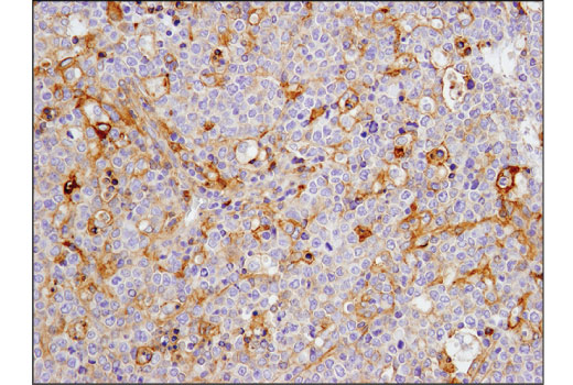 Immunohistochemistry Image 2: CD40 (D8W3N) Rabbit Monoclonal Antibody