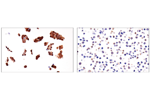 Immunohistochemistry Image 2: IDH1 (RcMab-1) Rat Monoclonal Antibody