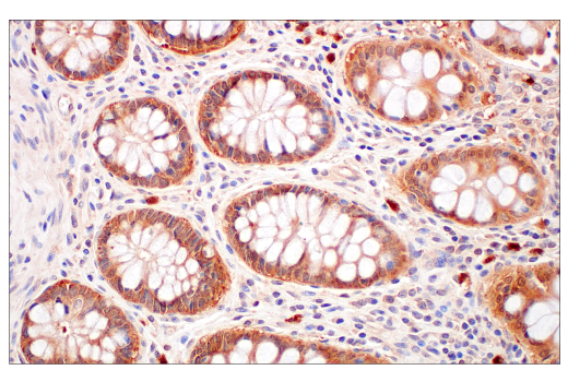 undefined Image 29: Gluconeogenesis Antibody Sampler Kit