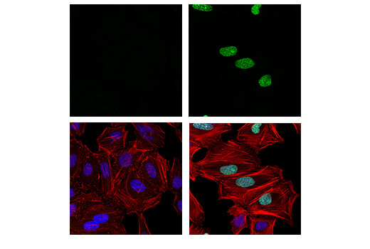Immunofluorescence Image 1: Phospho-RPA32/RPA2 (Ser8) (E5A2F) Rabbit Monoclonal Antibody