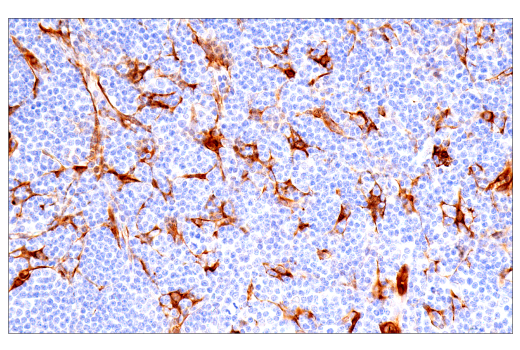 Immunohistochemistry Image 4: CRP2 (E8R5N) Rabbit Monoclonal Antibody