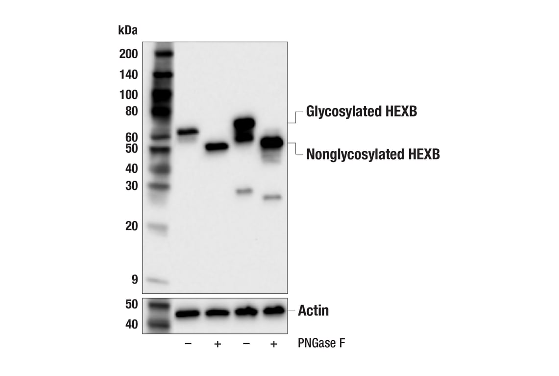 Western Blotting Image 2: HEXB (E9X5S) Rabbit Monoclonal Antibody (BSA and Azide Free)