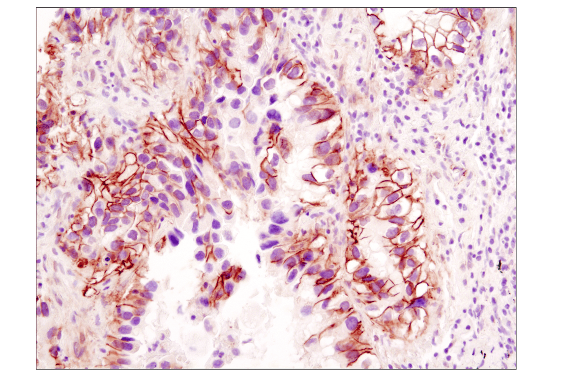 Immunohistochemistry Image 1: beta-Catenin (D10A8) Rabbit Monoclonal Antibody (BSA and Azide Free)