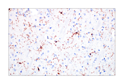 Immunohistochemistry Image 5: Integrin beta2 (E9O7W) Rabbit Monoclonal Antibody (BSA and Azide Free)