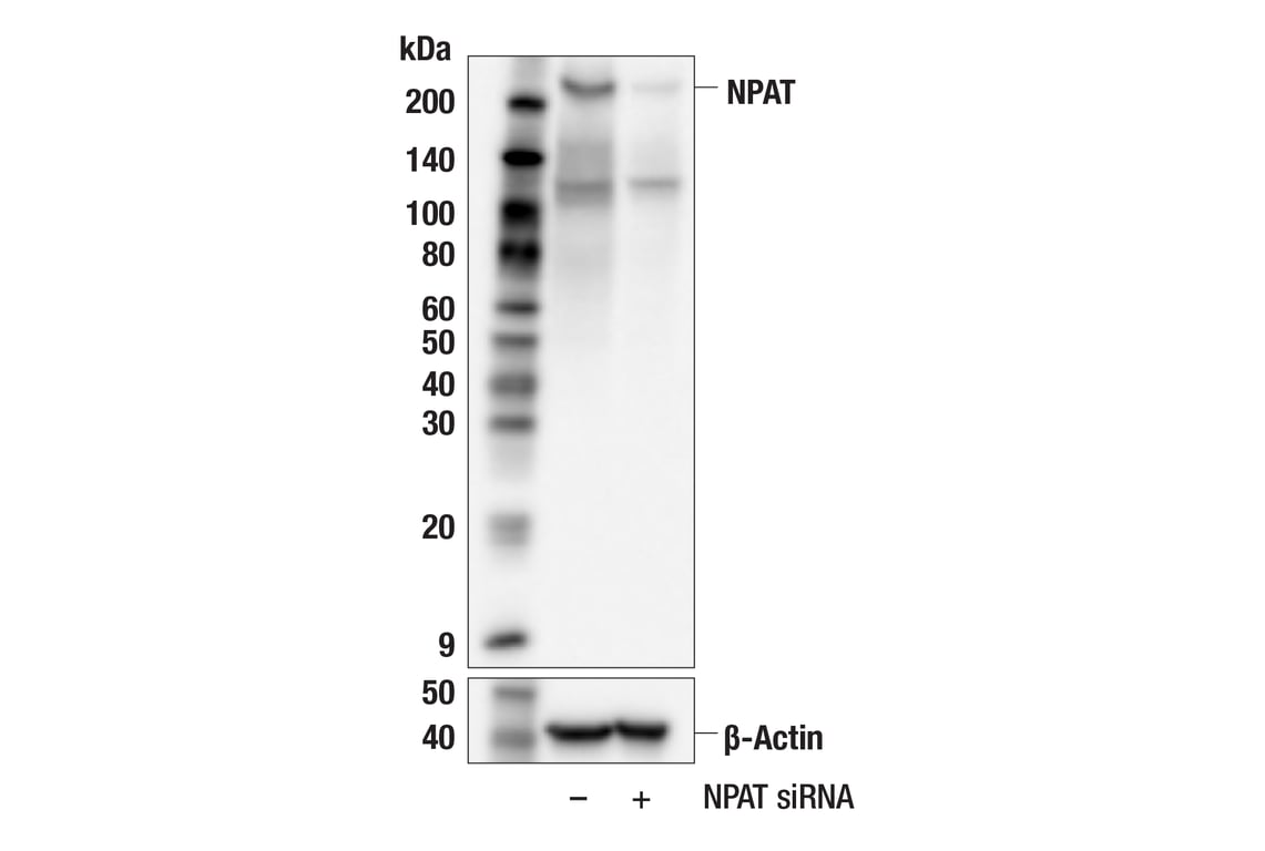 Western Blotting Image 2: NPAT (F1D9Q) Rabbit Monoclonal Antibody