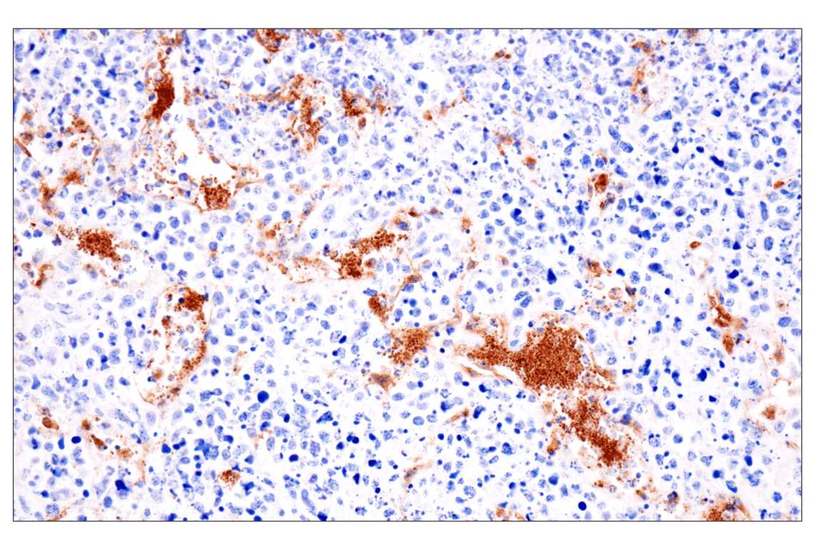 Immunohistochemistry Image 3: ESAM (F9D9P) Rabbit Monoclonal Antibody