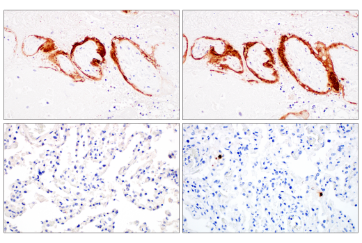 Immunohistochemistry Image 2: SARS-CoV-1/2 Spike Protein (2B3E5) Mouse Monoclonal Antibody