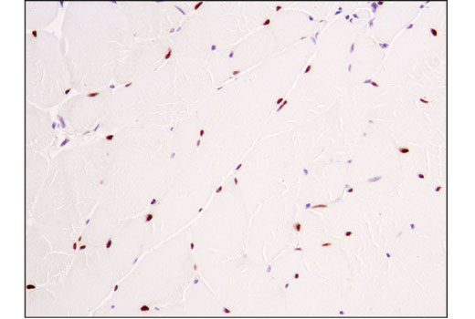 Immunohistochemistry Image 2: SIX1 (D5S2S) Rabbit Monoclonal Antibody