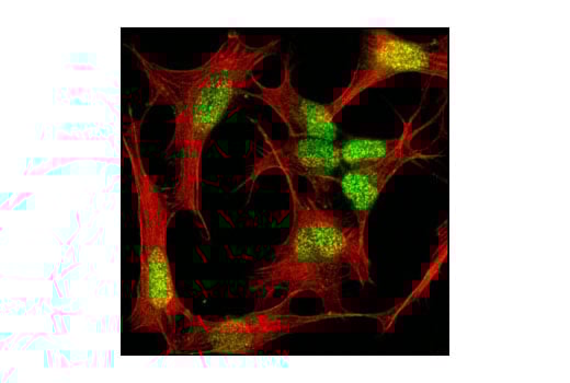 Immunofluorescence Image 1: MeCP2 (D4F3) Rabbit Monoclonal Antibody