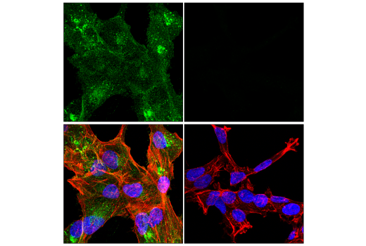 Cytotoxin / Radiophobia【輸入盤】 LTβR (E5I6X) Rabbit mAb | Cell Signaling Technology