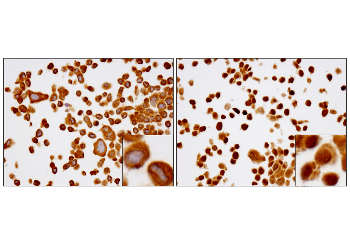 Immunohistochemistry Image 1: NF-kappaB p65 (D14E12) Rabbit Monoclonal Antibody (BSA and Azide Free)