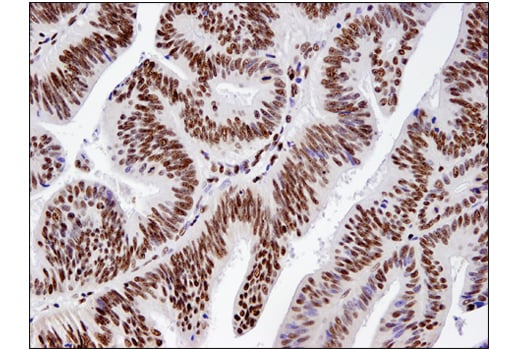 Immunohistochemistry Image 2: BRM (D9E8B) Rabbit Monoclonal Antibody (BSA and Azide Free)