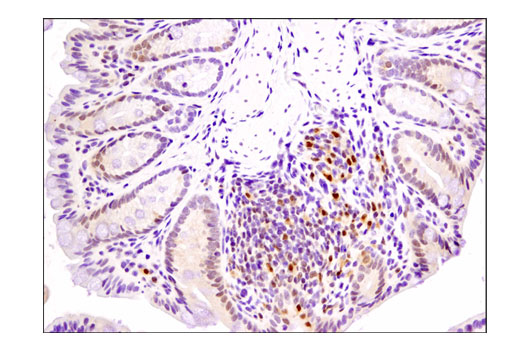 Immunohistochemistry Image 2: Phospho-p38 MAPK (Thr180/Tyr182) (D3F9) Rabbit Monoclonal Antibody (BSA and Azide Free)
