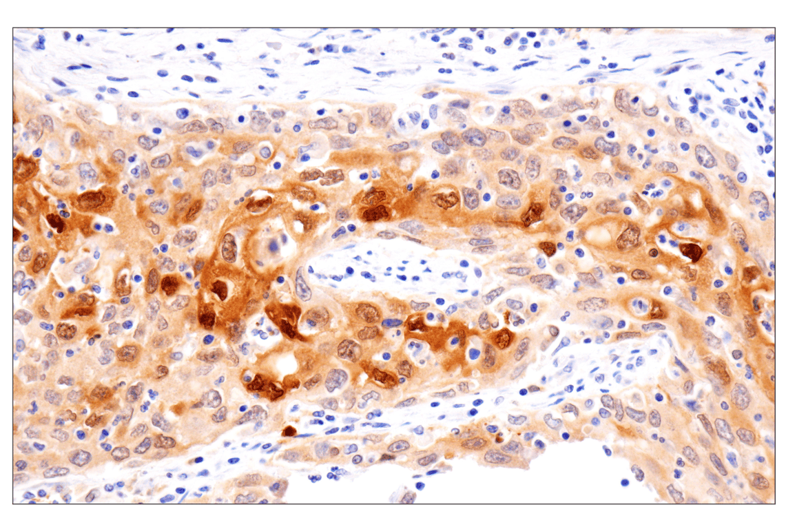 Immunohistochemistry Image 2: APOBEC3A (UMN-13) Rabbit Monoclonal Antibody (BSA and Azide Free)