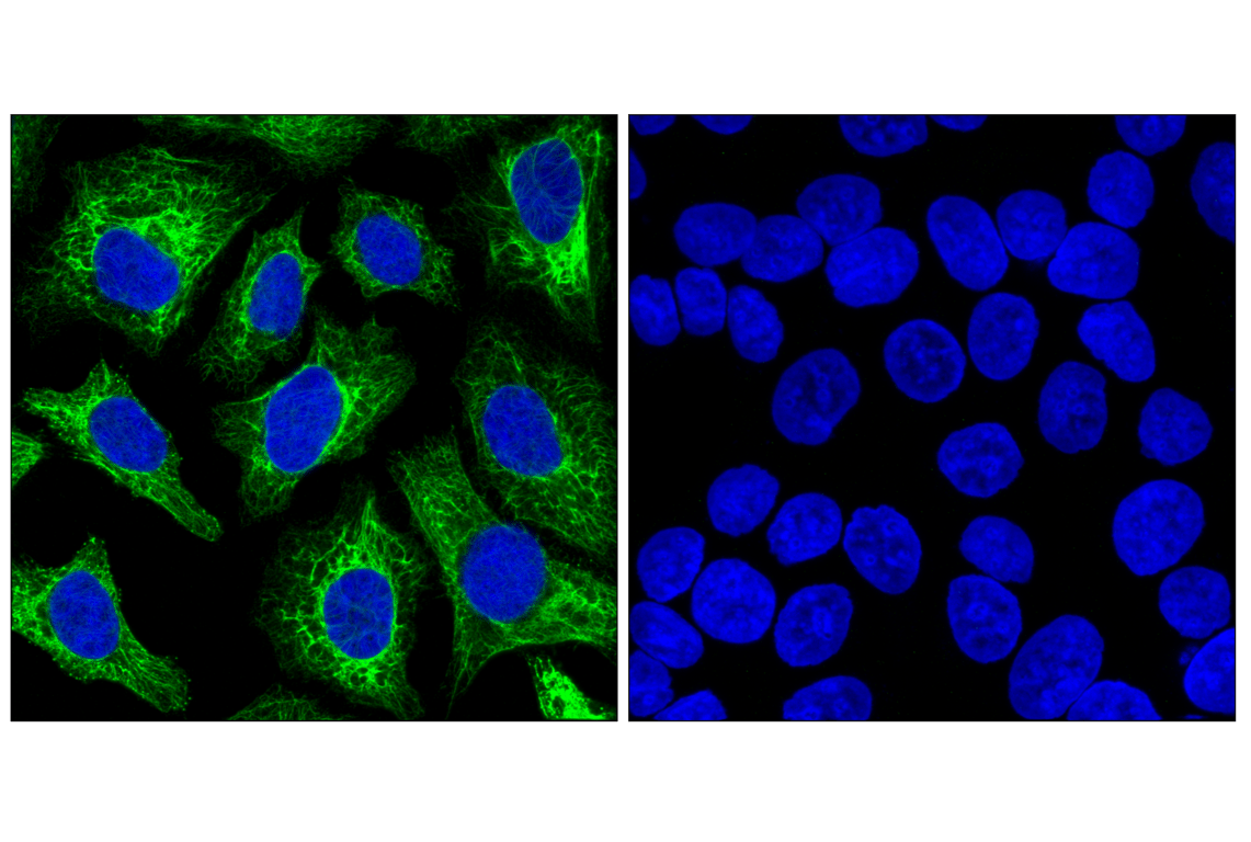 Immunofluorescence Image 1: Keratin 7 (R458) Antibody