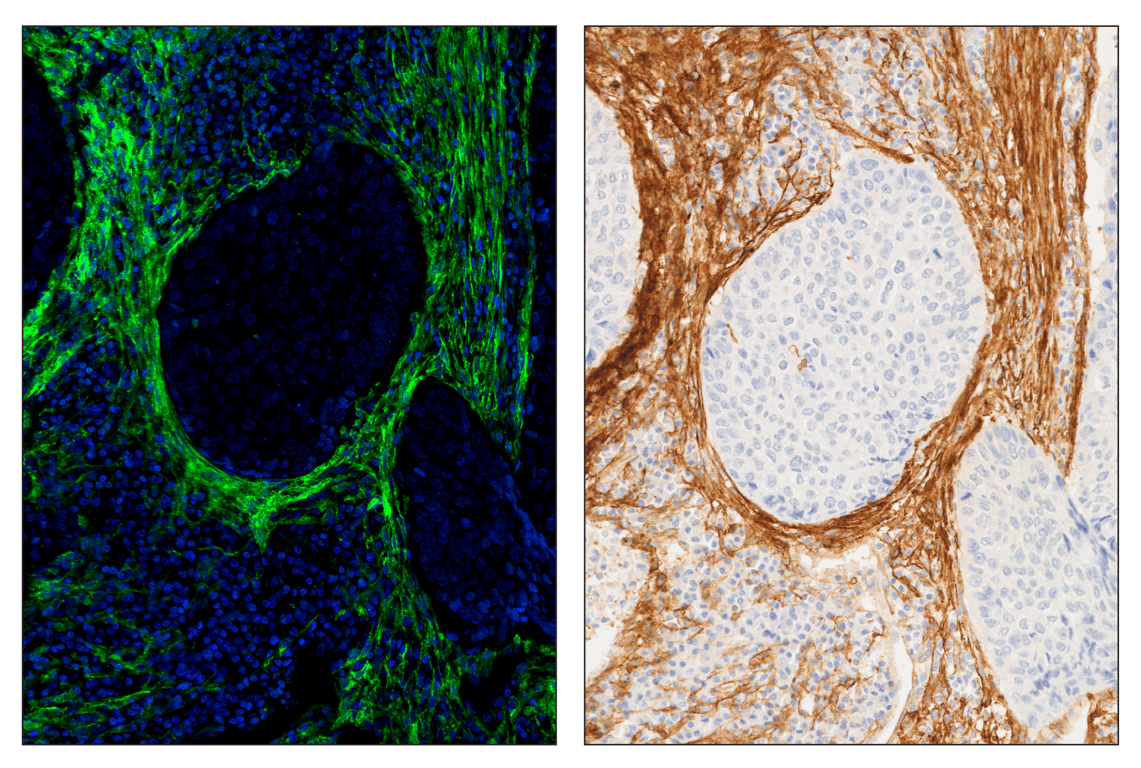 Immunohistochemistry Image 6: FAP (F1A4G) & CO-0116-594 SignalStar<sup>™</sup> Oligo-Antibody Pair