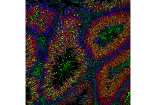 Immunofluorescence Image 1: Acetyl-α-Tubulin (Lys40) (6-11B-1) Mouse mAb
